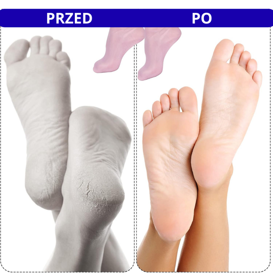 Skarpetki Pielęgnacyjne - Gładkie Stopy Po Pierwszym Użyciu